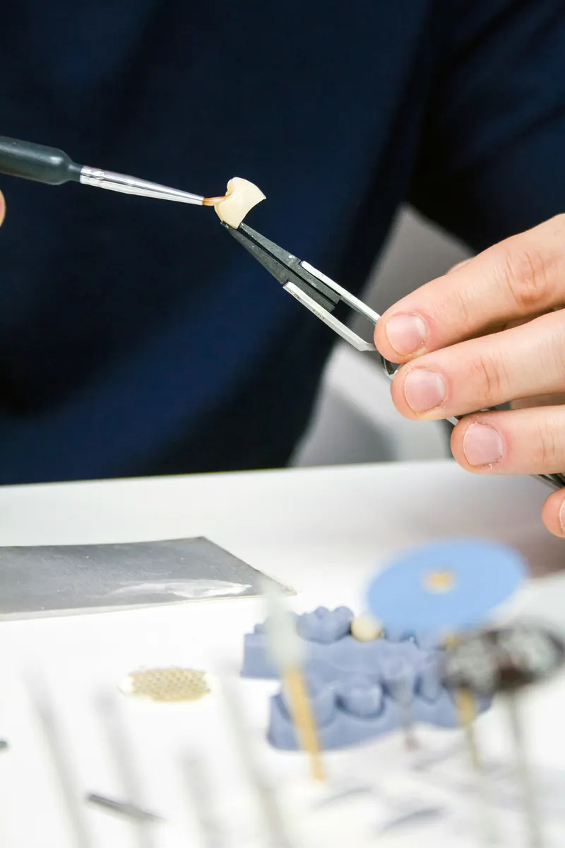Lucru de precizie asupra unei restaurări dentare